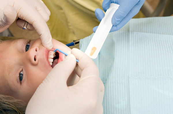 Young boy receiving fluoride treatment at Stephen L Ruchlin DDS in Rochester.