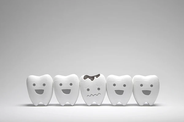 Row of five toy teeth, all smiling except for the middle tooth which frowns because of tooth decay