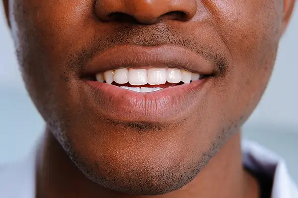 A close-up of a man smiling, showcasing clean and white teeth, representing good oral hygiene and dental care.